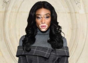 Winnie Harlow